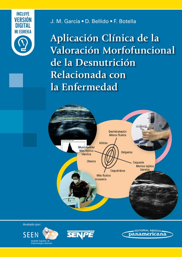 Portada de Aplicación Clínica de la Valoración Morfofuncional de la Desnutrición Relacionada con la Enfermedad