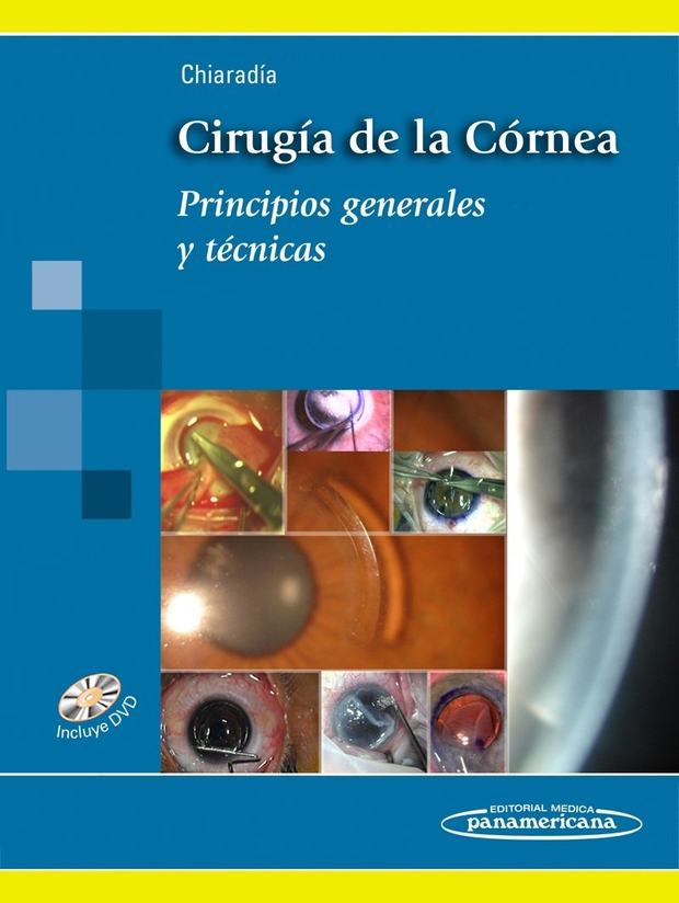 Portada de Cirugía de la Córnea