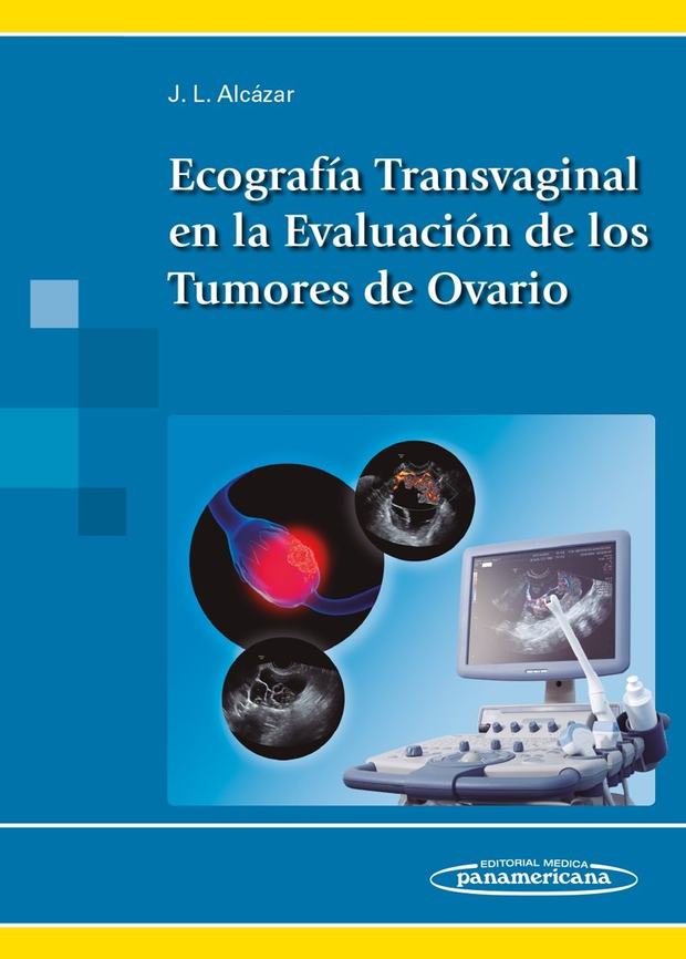 Portada de Ecografía Transvaginal en la Evaluación de los Tumores de Ovario