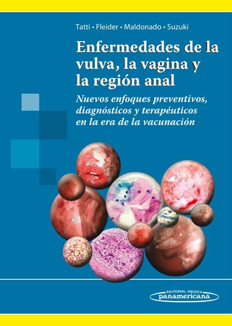 Portada de Enfermedades de la Vulva, la Vagina y la Región Anal