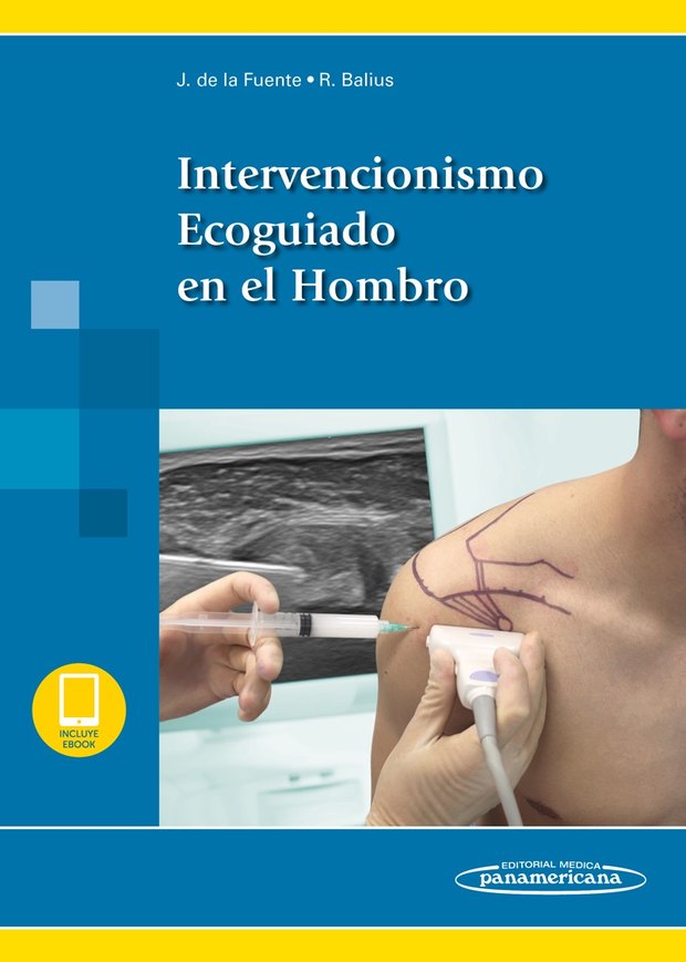 Portada de Intervencionismo Ecoguiado en el Hombro