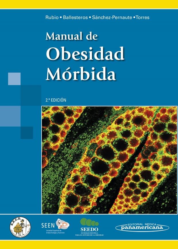 Portada de Manual de Obesidad Mórbida