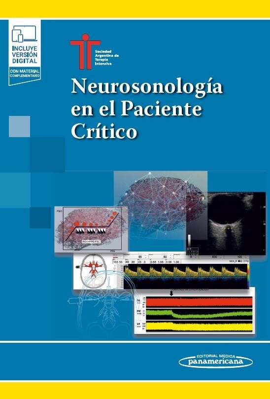 Portada de Neurosonología en el Paciente Crítico