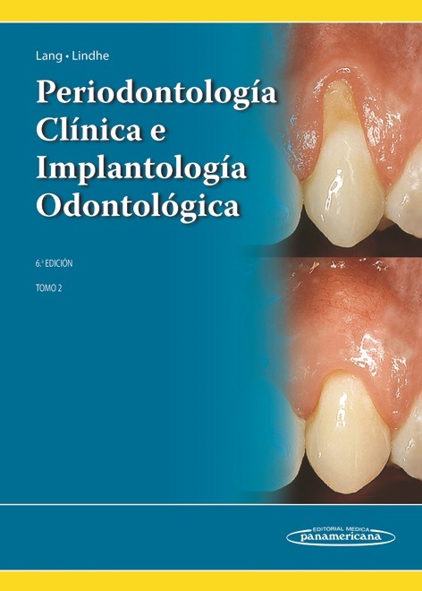Portada de Periodontología Clínica e Implantología Odontológica. Tomo 1