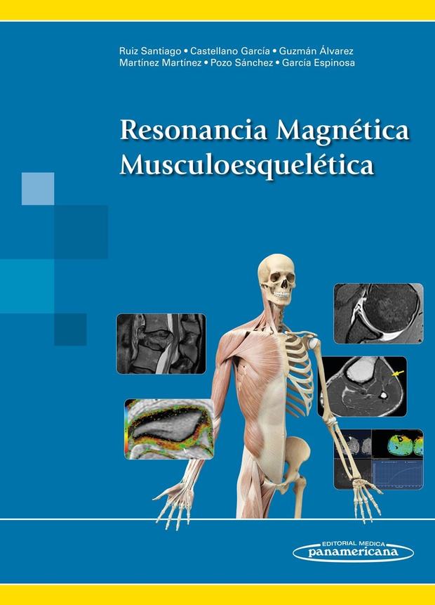 Portada de Resonancia Magnética Musculoesquelética