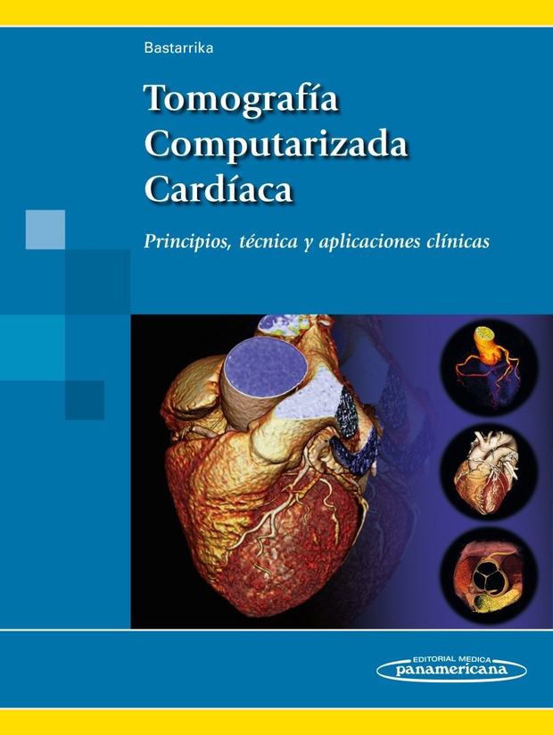 Portada de Tomografía Computarizada Cardíaca