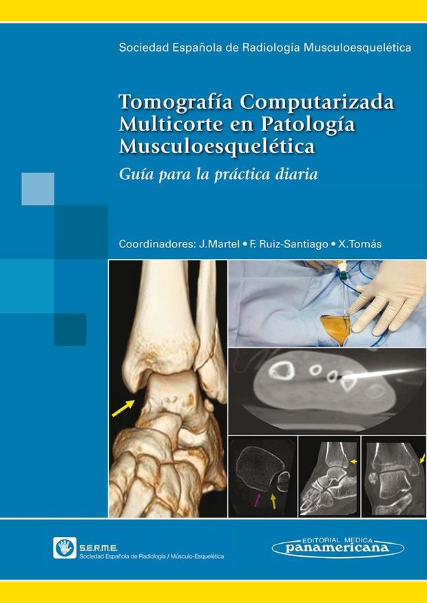 Portada de Tomografía Computarizada Multicorte en Patología Musculoesquelética