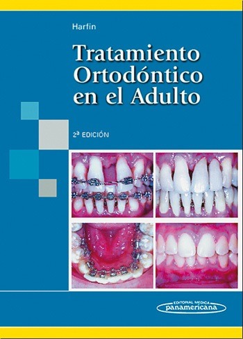 Portada de Tratamiento Ortodóntico en el Adulto